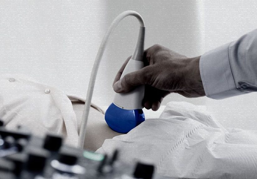 Can an ultrasound detect ovarian cancer?