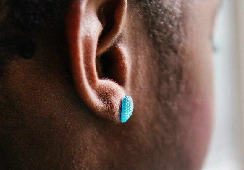 Can CMV Cause Hearing Loss?