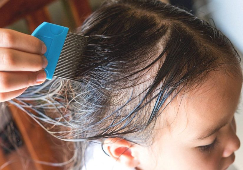 Drug-Resistant Super Lice: Symptoms, Treatment, and Prevention