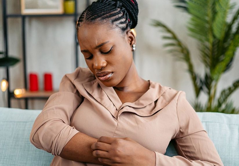 Eczema: High Levels of Sodium May Increase Symptoms
