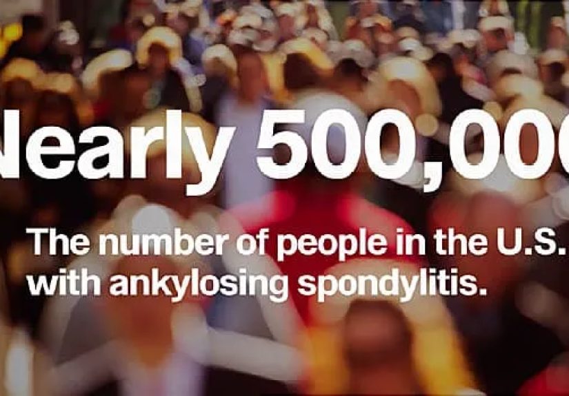 Fast Facts About Ankylosing Spondylitis (AS)