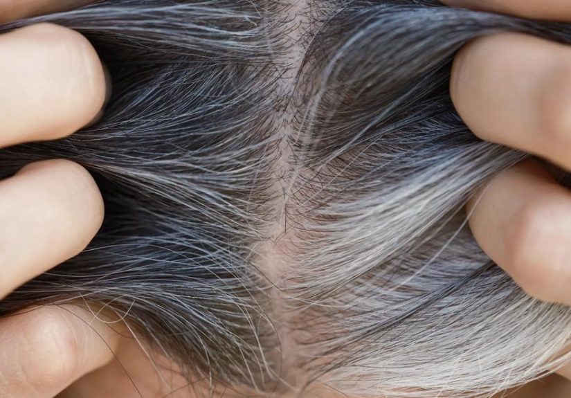 Gray Hair: Causes and What To Do About It