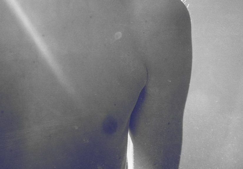 Nipple eczema: Symptoms, treatment, and alternative diagnoses