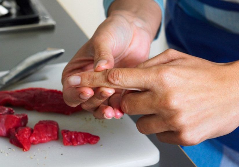 Super Glue on Cuts: When and Why to Use It