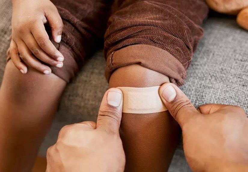 When Does a Cut Need Stitches?