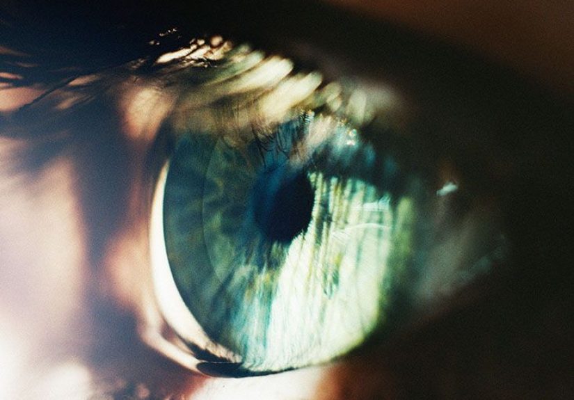 Atopic keratoconjunctivitis: Symptoms, causes, treatment