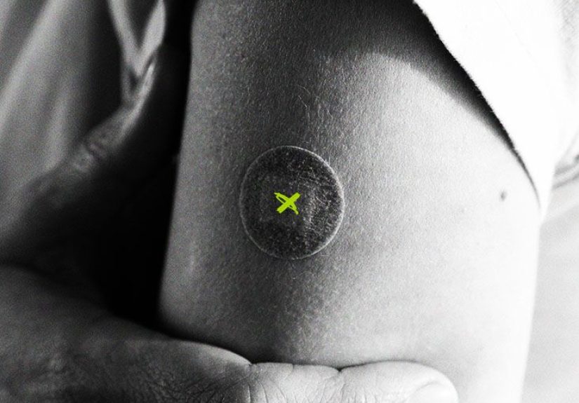 Hepatitis A vs. B: Differences, similarities, and prevention