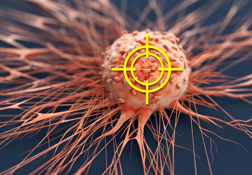 Myelofibrosis Treatments