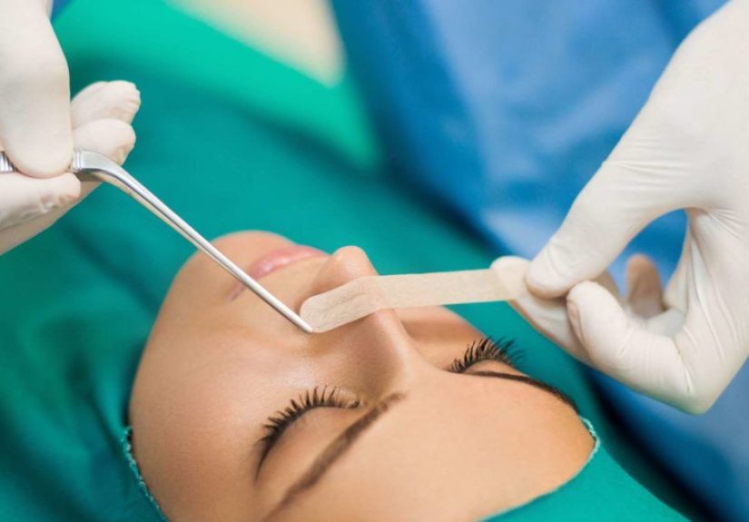 Septoplasty: What to Expect, Risks, and Reasons for Surgery