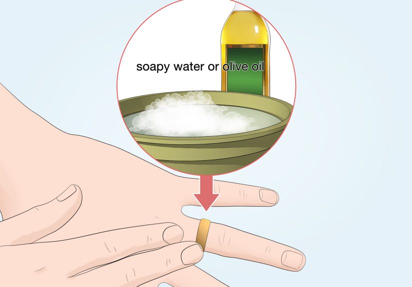 Simple Ways to Remove a Ring with a String: 9 Steps