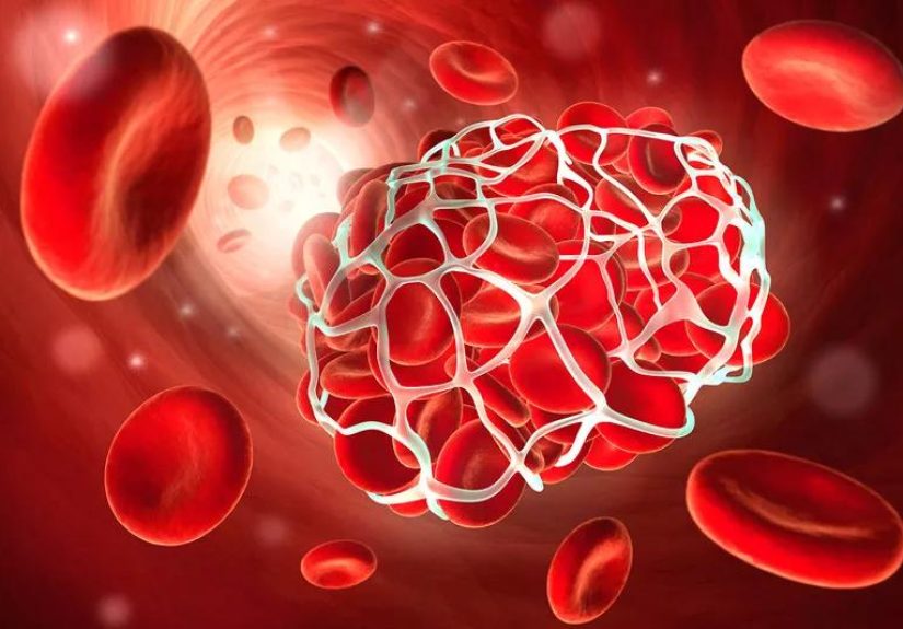 Why Vitamin K Can Be Dangerous If You Take Warfarin