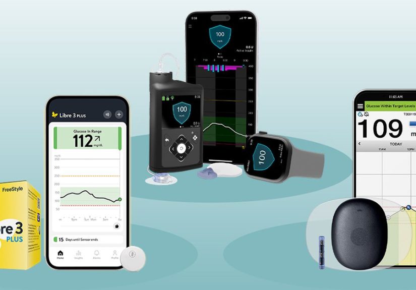 3 Blood Sugar Monitors Without Finger Pricks