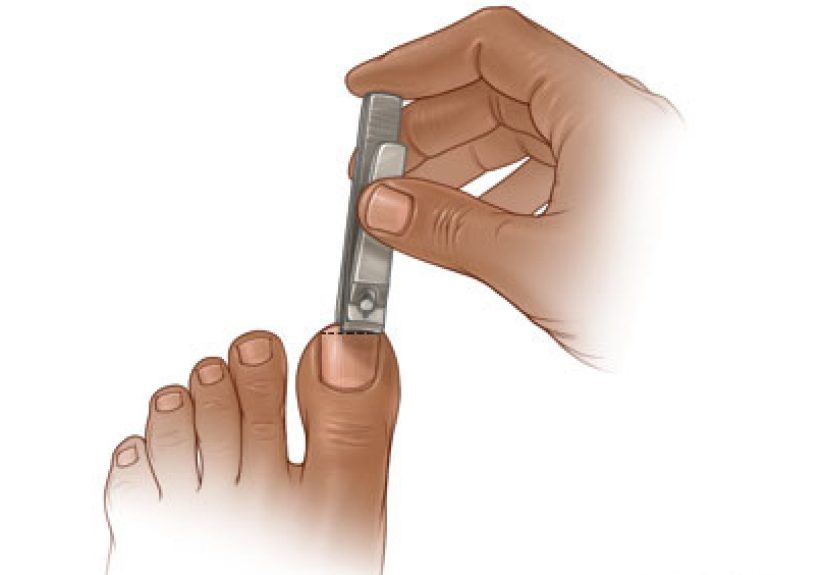 #855 When You Cut Off Your Disgusting Big Toenail - 1000 Awesome Things