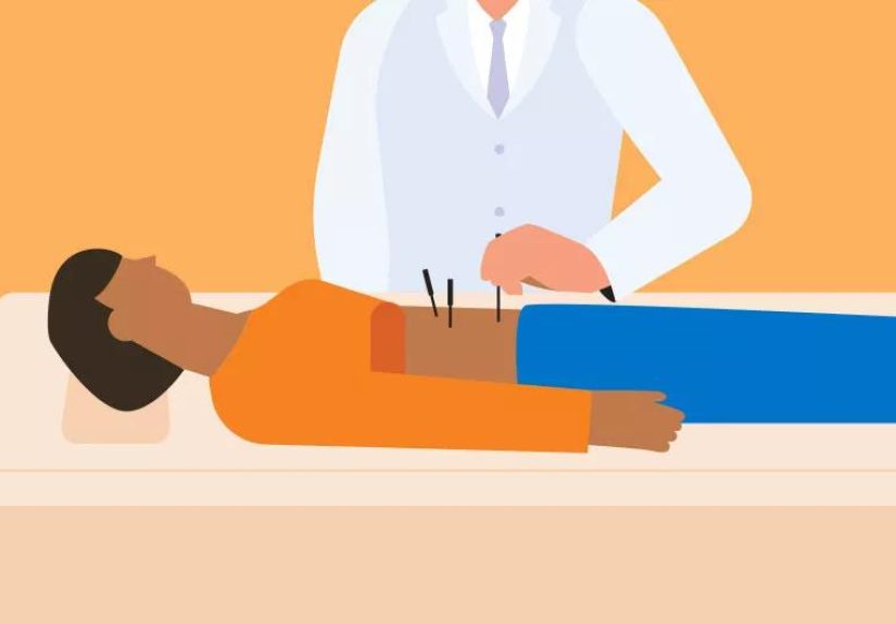 Acupuncture for Fertility: Does It Really Work?