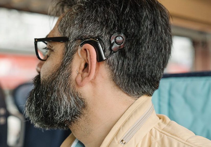 How Cochlear Implants Contribute to Hearing Fatigue