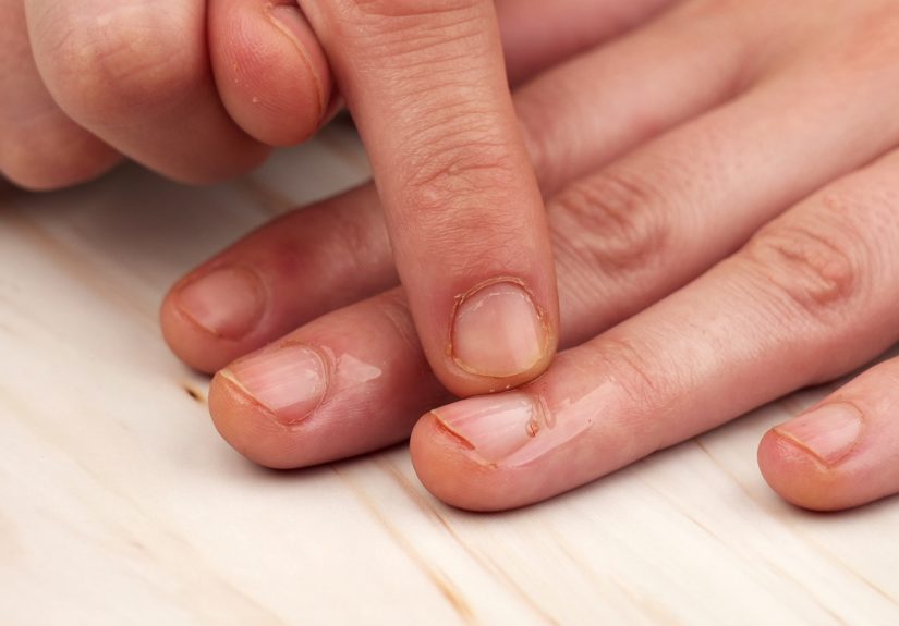 How to Apply Cuticle Oil (Step-By-Step) & When to Use It