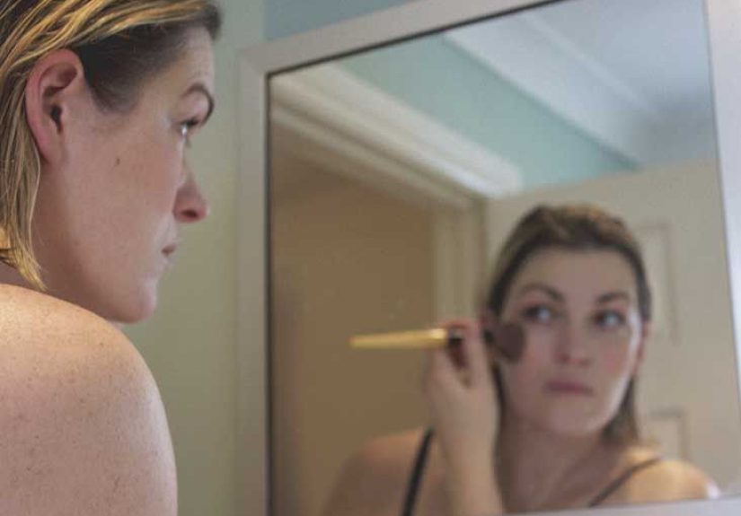 Hypopigmentation: Causes, Risk Factors, Treatments, More