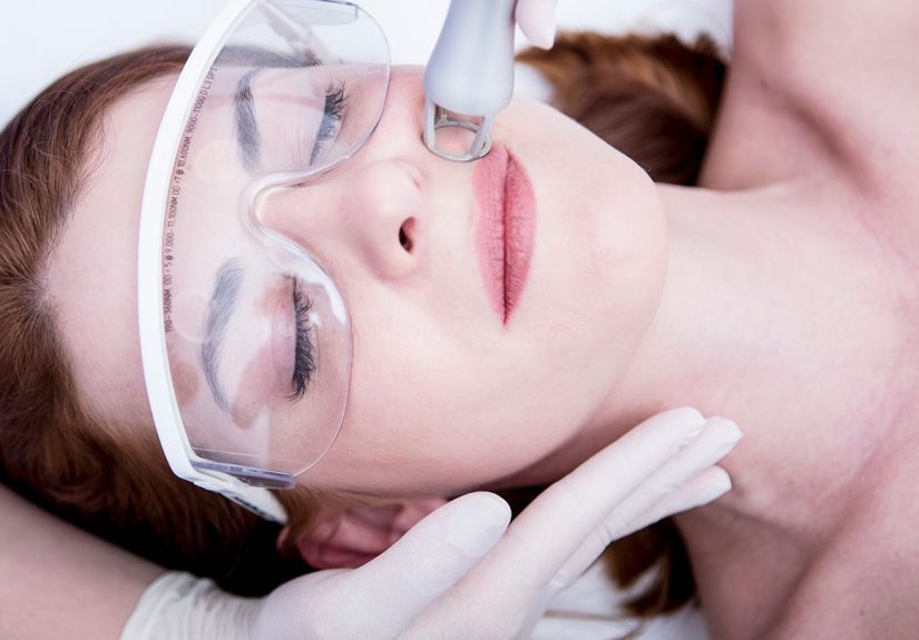 Laser Resurfacing for Better Skin: 9 Things You Must Know