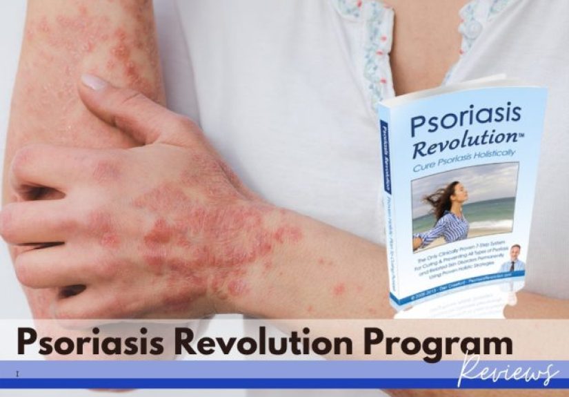 Psoriasis Revolution Review 2025 • Consumer Report! • Is it a Scam?