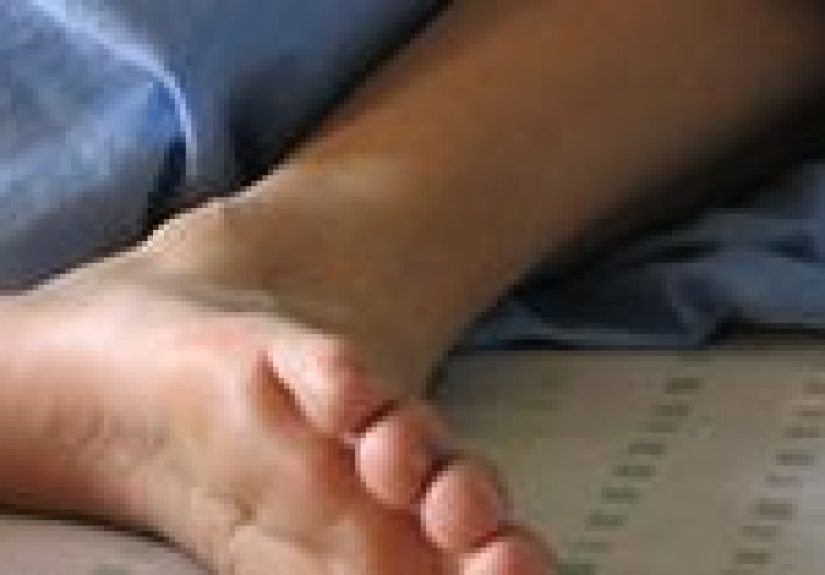 Restless Leg Syndrome: Causes, Home Remedies, and More