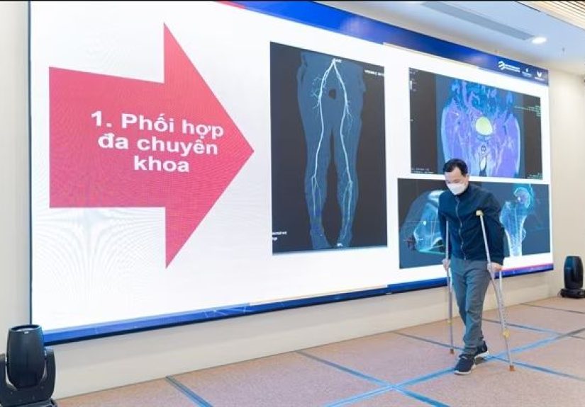 3D Printed Pelvis And Femur Implants For Bone Cancer Treatment