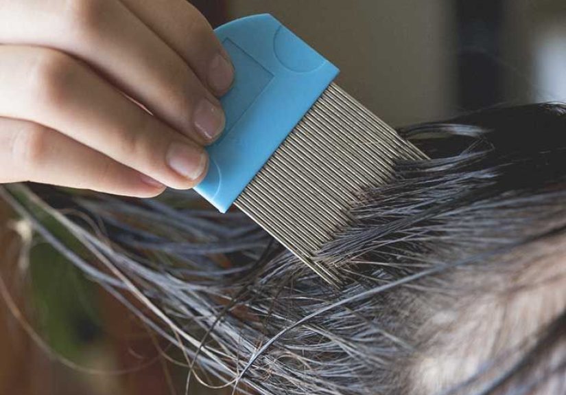 7 Common Lice Symptoms: Do You Have Lice?