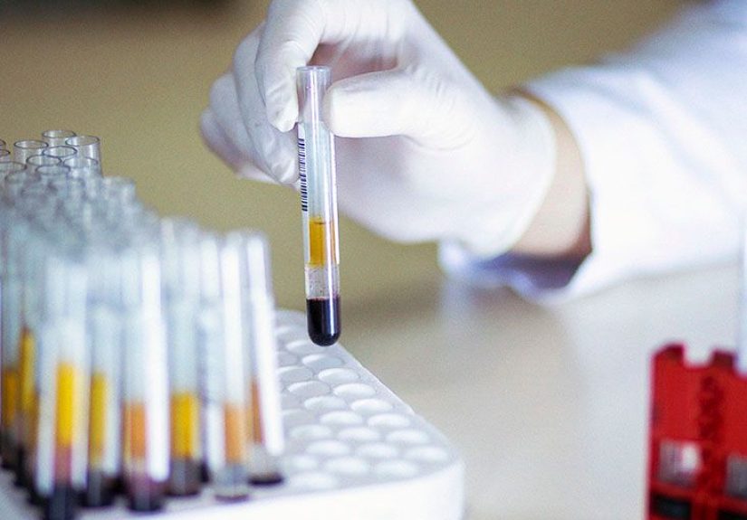 Acute promyelocytic leukemia (APL): Symptoms, treatment, outlook