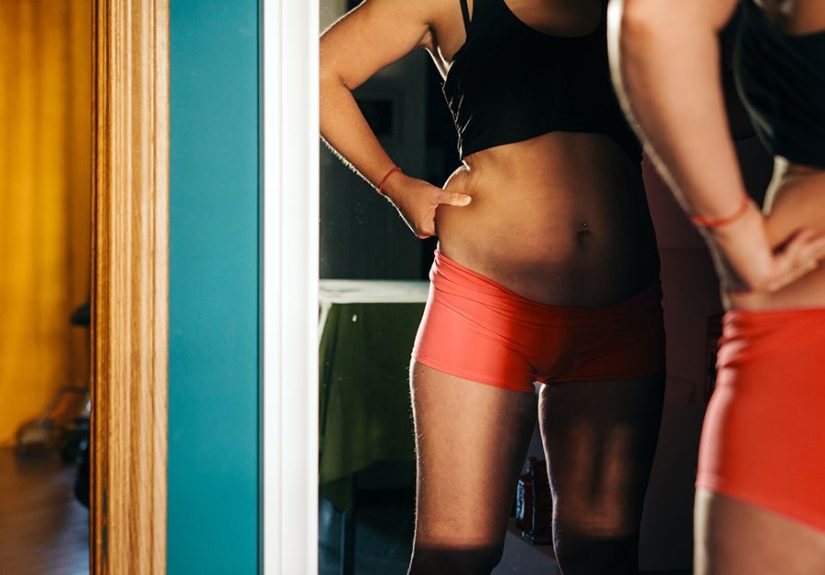 Atypical Anorexia Nervosa: Symptoms, Causes, Treatment