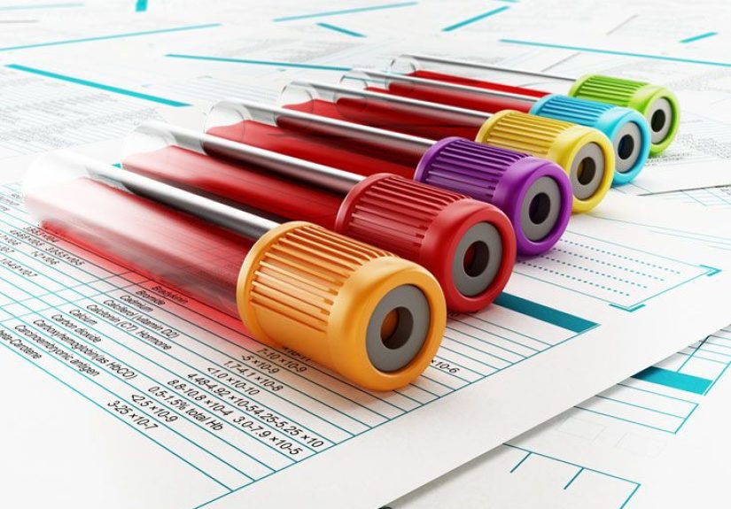 Blood Osmolality Test