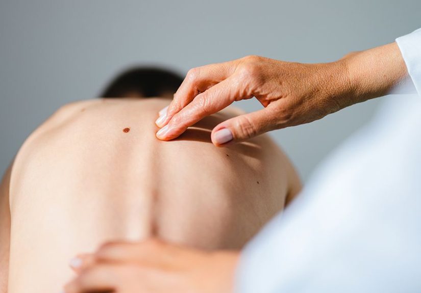 Chiropractic for Scoliosis: Does It Help Treat it or Its Symptoms?