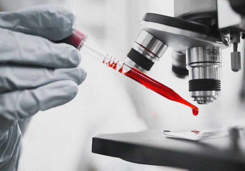 Complete Blood Count: Definition, Purpose, Results, and More