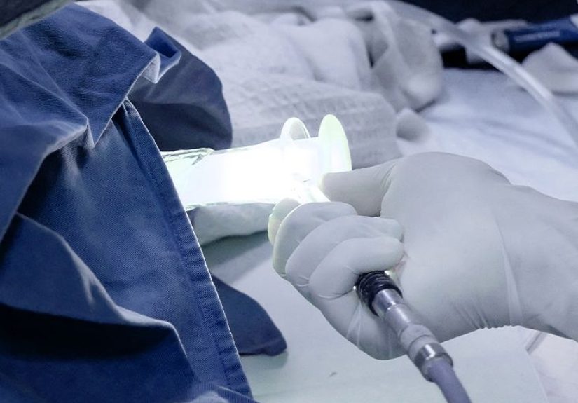 What Is Proctoscopy, and What Are Its Uses?
